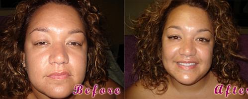 beforeafter1