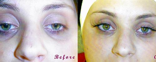 beforeafter2