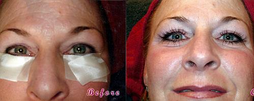 beforeafter3